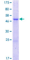 HTTY1 / TTYH1 Protein - 12.5% SDS-PAGE of human TTYH1 stained with Coomassie Blue