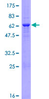 HUM2DD / DHDH Protein - 12.5% SDS-PAGE of human DHDH stained with Coomassie Blue