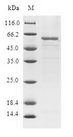 HUM2DD / DHDH Protein - (Tris-Glycine gel) Discontinuous SDS-PAGE (reduced) with 5% enrichment gel and 15% separation gel.