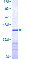 HUM2DD / DHDH Protein - 12.5% SDS-PAGE Stained with Coomassie Blue.