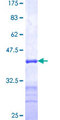 HUM2DD / DHDH Protein - 12.5% SDS-PAGE Stained with Coomassie Blue.