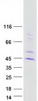 HUM2DD / DHDH Protein - Purified recombinant protein DHDH was analyzed by SDS-PAGE gel and Coomassie Blue Staining