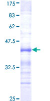 HUNK / B19 Protein - 12.5% SDS-PAGE Stained with Coomassie Blue.