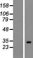 HUS1B Protein - Western validation with an anti-DDK antibody * L: Control HEK293 lysate R: Over-expression lysate