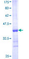 HUWE1 / ARFBP1 Protein - 12.5% SDS-PAGE Stained with Coomassie Blue.