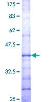 HYAL1 Protein - 12.5% SDS-PAGE Stained with Coomassie Blue.