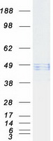 HYAL1 Protein - Purified recombinant protein HYAL1 was analyzed by SDS-PAGE gel and Coomassie Blue Staining