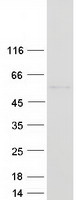 HYAL1 Protein - Purified recombinant protein HYAL1 was analyzed by SDS-PAGE gel and Coomassie Blue Staining