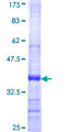 HYAL2 Protein - 12.5% SDS-PAGE Stained with Coomassie Blue