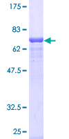 HYAL3 Protein - 12.5% SDS-PAGE of human HYAL3 stained with Coomassie Blue