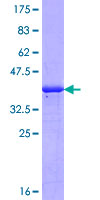 HYAL4 Protein - 12.5% SDS-PAGE Stained with Coomassie Blue.