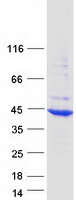 HYKK / AGPHD1 Protein - Purified recombinant protein HYKK was analyzed by SDS-PAGE gel and Coomassie Blue Staining