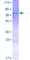 HYLS1 Protein - 12.5% SDS-PAGE of human HYLS1 stained with Coomassie Blue