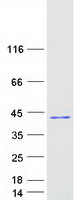 HYLS1 Protein - Purified recombinant protein HYLS1 was analyzed by SDS-PAGE gel and Coomassie Blue Staining