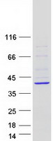 HYLS1 Protein - Purified recombinant protein HYLS1 was analyzed by SDS-PAGE gel and Coomassie Blue Staining