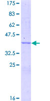 HYOU1 / ORP150 Protein - 12.5% SDS-PAGE of human HYOU1 stained with Coomassie Blue