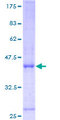 HYOU1 / ORP150 Protein - 12.5% SDS-PAGE of human HYOU1 stained with Coomassie Blue