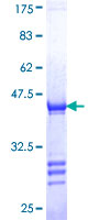 HYOU1 / ORP150 Protein - 12.5% SDS-PAGE Stained with Coomassie Blue.