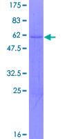 HZF16 / ZNF124 Protein - 12.5% SDS-PAGE of human ZNF124 stained with Coomassie Blue