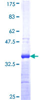 HZF16 / ZNF124 Protein - 12.5% SDS-PAGE Stained with Coomassie Blue.