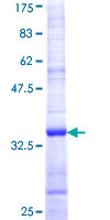 I-309 / CCL1 Protein - 12.5% SDS-PAGE Stained with Coomassie Blue.