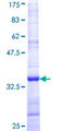 I-309 / CCL1 Protein - 12.5% SDS-PAGE Stained with Coomassie Blue.