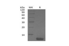 I-309 / CCL1 Protein - Recombinant Human CCL1/I-309 Protein-Elabscience