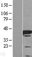 I-BABP / FABP6 Protein - Western validation with an anti-DDK antibody * L: Control HEK293 lysate R: Over-expression lysate