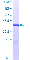 I-BABP / FABP6 Protein - 12.5% SDS-PAGE of human FABP6 stained with Coomassie Blue