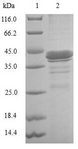 I-BABP / FABP6 Protein - (Tris-Glycine gel) Discontinuous SDS-PAGE (reduced) with 5% enrichment gel and 15% separation gel.