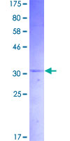 IAPP / Amylin Protein - 12.5% SDS-PAGE of human IAPP stained with Coomassie Blue