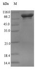 IAPP / Amylin Protein - (Tris-Glycine gel) Discontinuous SDS-PAGE (reduced) with 5% enrichment gel and 15% separation gel.