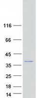 IBA57 / C1orf69 Protein - Purified recombinant protein IBA57 was analyzed by SDS-PAGE gel and Coomassie Blue Staining