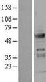 ICA69 / ICA1 Protein - Western validation with an anti-DDK antibody * L: Control HEK293 lysate R: Over-expression lysate