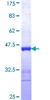ICA69 / ICA1 Protein - 12.5% SDS-PAGE Stained with Coomassie Blue.