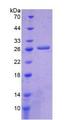 ICA69 / ICA1 Protein - Recombinant Islet Cell Autoantigen 1 By SDS-PAGE