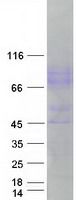 ICAM-1 / CD54 Protein - Purified recombinant protein ICAM1 was analyzed by SDS-PAGE gel and Coomassie Blue Staining