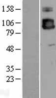 ICAM3 / CD50 Protein - Western validation with an anti-DDK antibody * L: Control HEK293 lysate R: Over-expression lysate