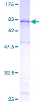 ICAM3 / CD50 Protein - 12.5% SDS-PAGE of human ICAM3 stained with Coomassie Blue