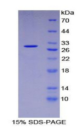 ICAM3 / CD50 Protein - Recombinant Intercellular Adhesion Molecule 3 By SDS-PAGE