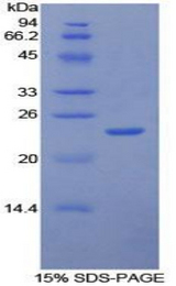 ICAM4 / CD242 Protein - Recombinant Intercellular Adhesion Molecule 4 By SDS-PAGE