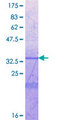ICAM5 / ICAM-5 Protein - 12.5% SDS-PAGE Stained with Coomassie Blue.