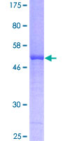 ICK Protein - 12.5% SDS-PAGE of human ICK stained with Coomassie Blue