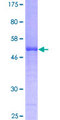 ICK Protein - 12.5% SDS-PAGE of human ICK stained with Coomassie Blue
