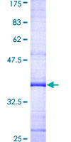 ICK Protein - 12.5% SDS-PAGE Stained with Coomassie Blue.