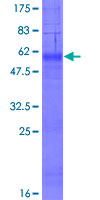 ICMT / PPMT Protein - 12.5% SDS-PAGE of human ICMT stained with Coomassie Blue