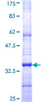 ICMT / PPMT Protein - 12.5% SDS-PAGE Stained with Coomassie Blue.