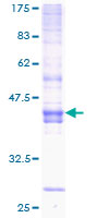 ICOS / CD278 Protein - 12.5% SDS-PAGE of human ICOS stained with Coomassie Blue