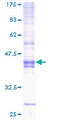 ICOS / CD278 Protein - 12.5% SDS-PAGE of human ICOS stained with Coomassie Blue