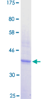 ICOS / CD278 Protein - 12.5% SDS-PAGE Stained with Coomassie Blue.